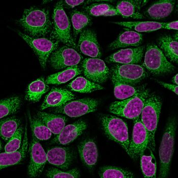 Calnexin (Endoplasmic Reticulum Marker) (CANX/1541), 0.2mg/mL
