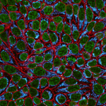 CellBrite
