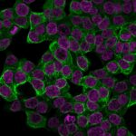 Cytokeratin-18-KRT18-2808R-CF488A-GAR-RedDot2-HCT116-120418