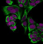 Cytokeratin18-C04-CF488A-MeOH-MCF7-3-ug-mL-RedDot2
