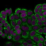 Cytokeratin18-DE-K18-CF488A-MeOH-MCF7-3ug-mL-RedDot2