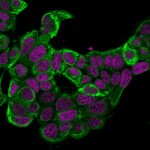 Cytokeratin18-KRT18-834-CF488A-PFA-MCF7-3ug-mL-RedDot2-1