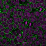 E-Cadherin-4A2-DCbiotin-CF488A-GAM-RedDot2-MCF7-111518