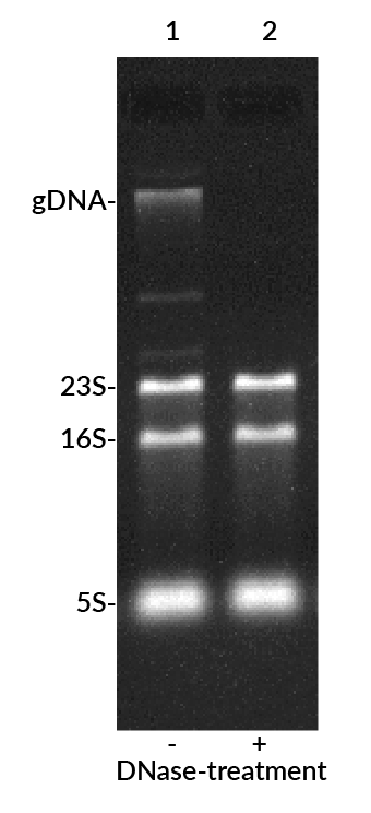 EMBER500-E-coli-RNA-DNase-labeled