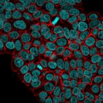 EPCAM-VU-1D9-DCCf555-Nucspot-1-12-06-2018MCF-1