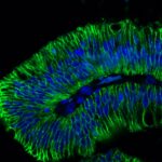 Ep-CAM / CD326 (Extracellular Domain) (Epithelial Marker) (EGP40/1798), CF740 conjugate, 0.1mg/mL
