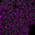Ep-CAM-HEA125-BiotinDC-CF488A-GAM-RedDot2-MCF7-111518