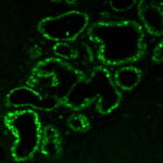 Estrogen-receptor-ER506-human-breast-FFPE-CF488A-tyramide