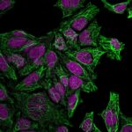 KRT7-760-CF488A-GAM-RedDot2-MeOH-HeLa-020119
