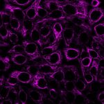 Mix-n-Stain-CF647-PAN-CK-5-ug-mL-MeOH-HeLa