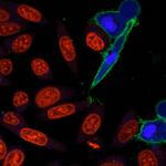 NucviewMicrovial