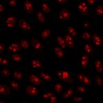 Nucleolin-364-5-CF594-HeLa