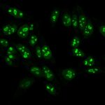 Nucleolin-NCL-902-CF488A-MnS-PFA-HeLa-032818