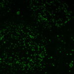 PD1-PDCD1-922-tonsil-CF488A-tyramide