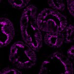 VIL-1325-APC-human-colon
