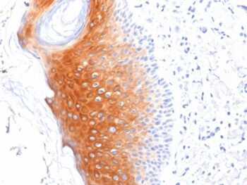 Cytokeratin 1 (Suprabasal Keratinocyte Marker)(LHK1), CF488A conjugate, 0.1mg/mL