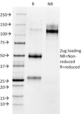 MMP3 (Marker of Metastasis and Rheumatoid Arthritis)(1B4), CF568 conjugate, 0.1mg/mL