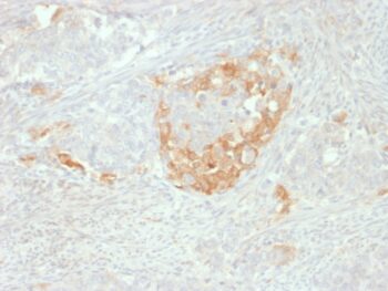 NSE gamma (Neuron Specific Enolase, gamma) (Neuroendocrine Marker)(NSE-P2), CF488A conjugate, 0.1mg/mL