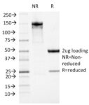 ATRX / RAD54 (Alpha Thalassemia Mental Retardation)(23c), 0.2mg/mL