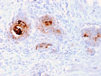TAG-72 / CA72.4 (Tumor-Associated Glycoprotein)(rB72.3), CF647 conjugate, 0.1mg/mL