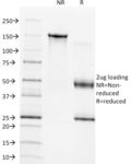 TIMP1 (Marker of Lymph Node Metastasis)(2A5), CF568 conjugate, 0.1mg/mL
