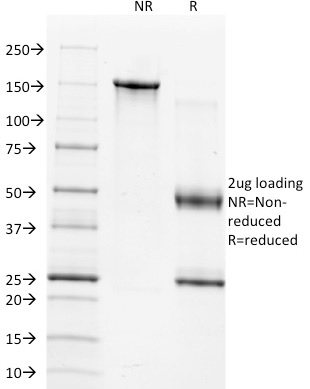 TIMP1 (Marker of Lymph Node Metastasis)(2A5), CF568 conjugate, 0.1mg/mL