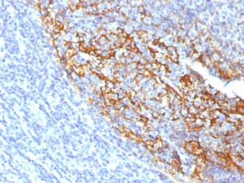 CD35 / CR1 (Follicular Dendritic Cell Marker)(To5), 0.2mg/mL