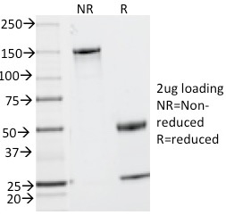 CD2 / Lymphocyte Function Antigen 2 (LFA-2)(UMCD2),  CF405S conjugate, 0.1mg/mL