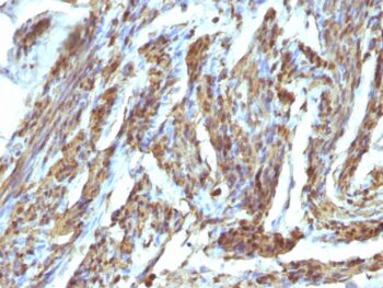 Calponin-1 (Smooth Muscle Marker), 0.2mg/mL