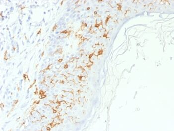 CD1a / HTA1 (Mature Langerhans Cells Marker), 0.2mg/mL