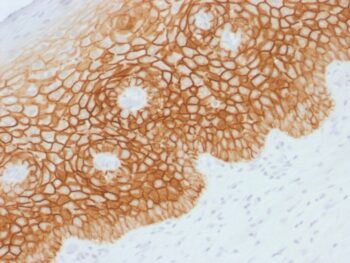 CD44v4 (Marker of Tumor Metastasis), 0.2mg/mL
