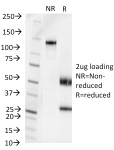 Pseudomonas aeruginosa serotype 6C(1200/472),  CF740 conjugate, 0.1mg/mL