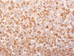 ACTH (Adrenocorticotrophic Hormone) (N-Terminal) (Pituitary Marker) (r57), CF740 conjugate, 0.1mg/mL
