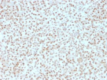 AKT1 (Prognostic Marker for Neuroendocrine Tumors)(AKT1/2491), 0.2mg/mL