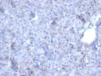 AKT1 (Prognostic Marker for Neuroendocrine Tumors)(AKT1/2784), 0.2mg/mL