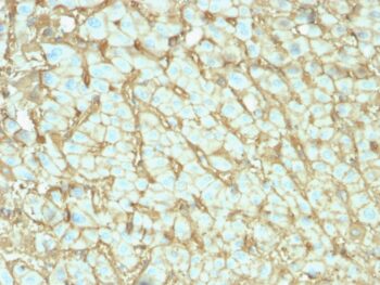 Albumin (Transport Protein)(ALB/2142), 0.2mg/mL