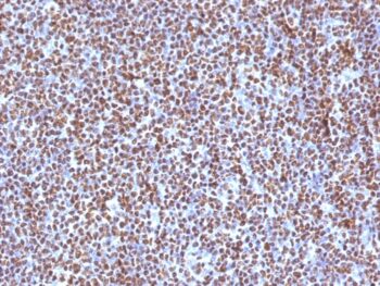 ALK (Anaplastic Lymphoma Kinase) / CD246(ALK/1504), 1mg/mL
