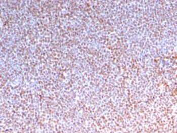 ALK (Anaplastic Lymphoma Kinase) / CD246(ALK/3218R), CF405S conjugate, 0.1mg/mL