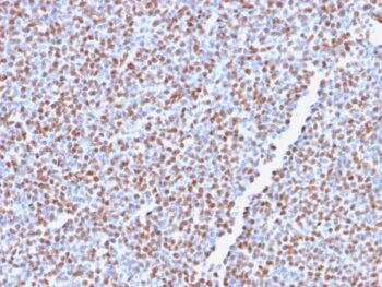 ALK (Anaplastic Lymphoma Kinase) / CD246(ALK1/2766R), 0.2mg/mL