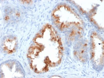 AMACR / p504S (Prostate Cancer Marker)(AMACR/1864), 0.2mg/mL
