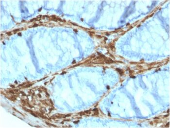 Annexin A1 / (Hairy Cell Leukemia Marker)(ANXA1/3566), 0.2mg/mL