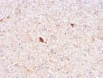 Serum Amyloid P / APCS(APCS/3240), CF568 conjugate, 0.1mg/mL 1 view_image-232