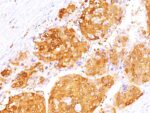 Arginase 1 (Hepatocellular Carcinoma Marker)(ARG1/1125+ ARG1/1126), 0.2mg/mL