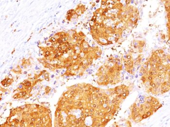 Arginase 1 (Hepatocellular Carcinoma Marker)(ARG1/1125+ ARG1/1126), 0.2mg/mL