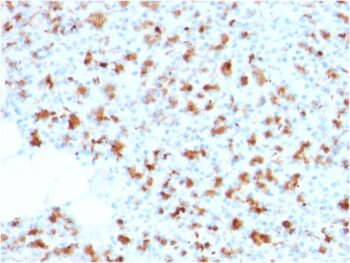 BARX1 (Prognostic Biomarker in Hepatocellular Carcinoma)(BARX1/2759), 0.2mg/mL