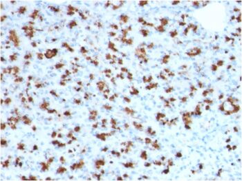 BARX1 (Prognostic Biomarker in Hepatocellular Carcinoma)(BARX1/2760), 0.2mg/mL