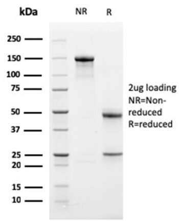 Bcl-X (Apoptosis Marker)(BCL2L1/1762), 0.2mg/mL
