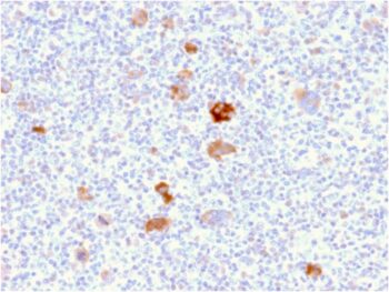 Bcl-X (Apoptosis Marker)(BCL2L1/2406), 0.2mg/mL