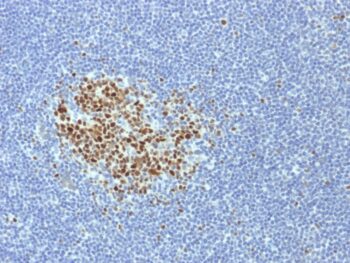 Bcl-6 (Follicular Lymphoma Marker)(BCL6/1718), 1mg/mL