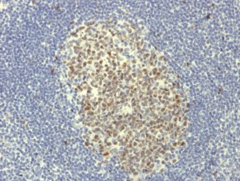 Bcl-6 (Follicular Lymphoma Marker) (BCL6/1951R), CF640R conjugate, 0.1mg/mL